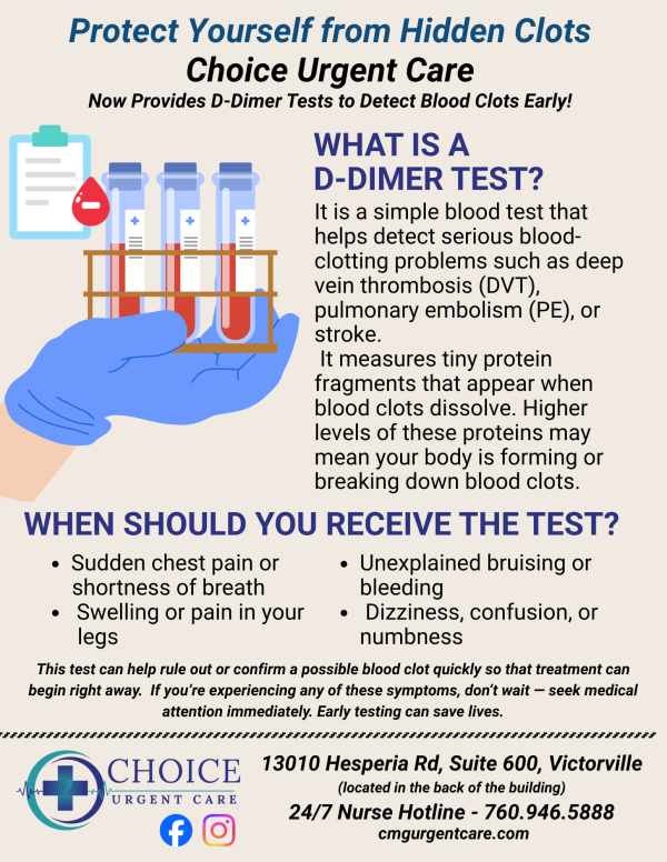 troponin d-dimer fliers (1)