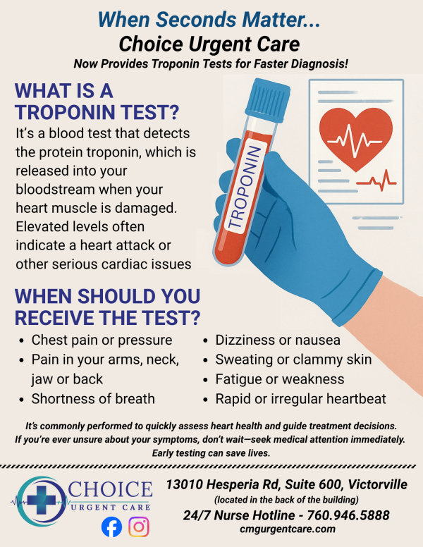 troponin d-dimer fliers